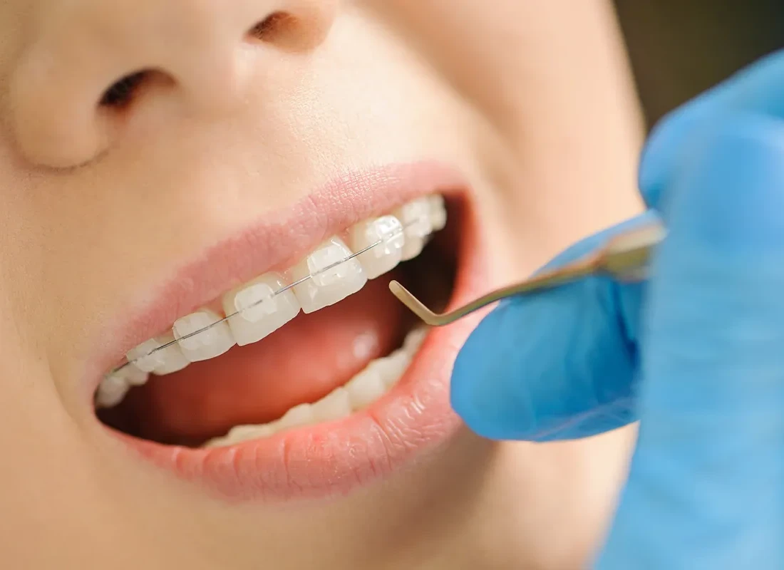Preventive Dentistry at Tammy N. Tran, D.D.S., Inc. in Long Beach, CA