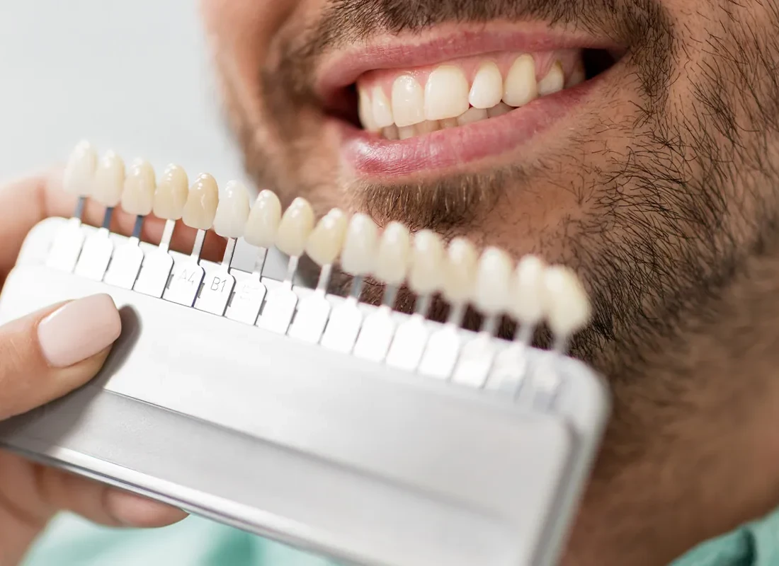 Teeth Whitening at Tammy N. Tran, D.D.S., Inc. in Long Beach, CA