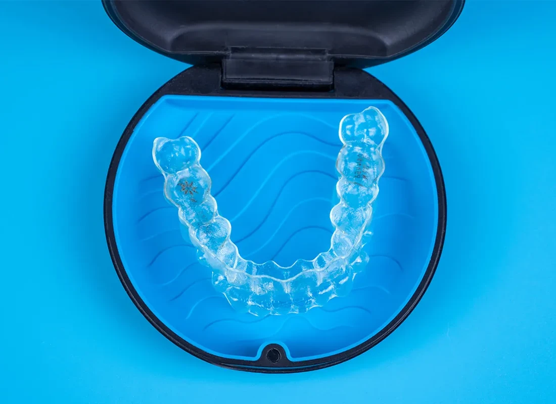 Signs you may need Invisalign Clear Aligners — Tammy N. Tran, D.D.S., Inc.