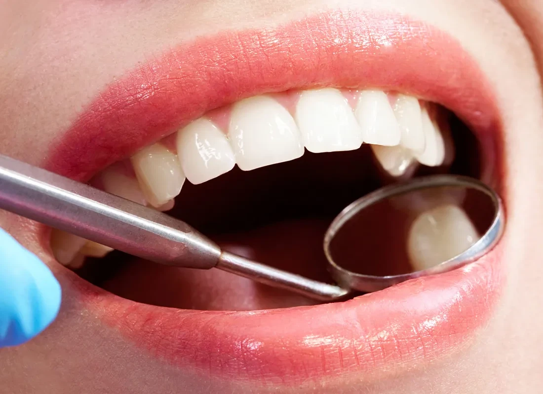 Patient in dental chair during a routine checkup