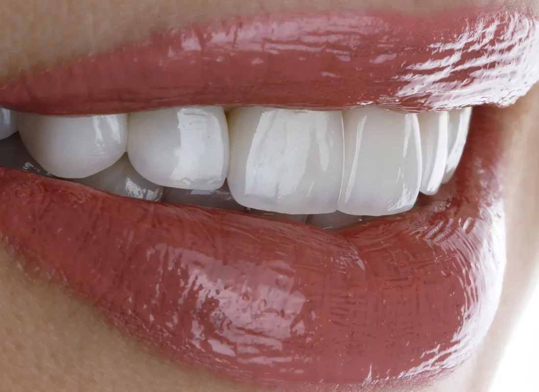 Signs you may need Gum Grafting — Tammy N. Tran, D.D.S., Inc.