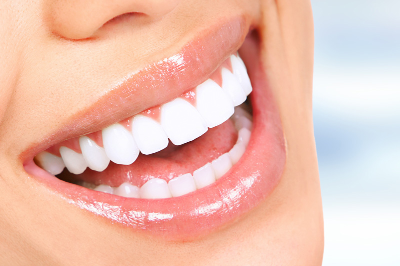 Cosmetic Dentistry in Long Beach