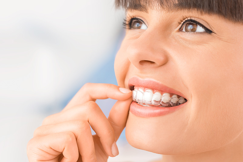 Invisalign in Long Beach