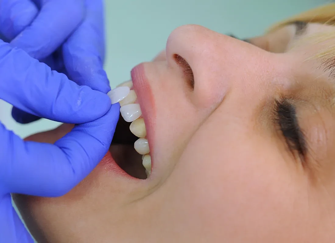 Cosmetic Veneers at Tammy N. Tran, D.D.S., Inc. in Long Beach, CA