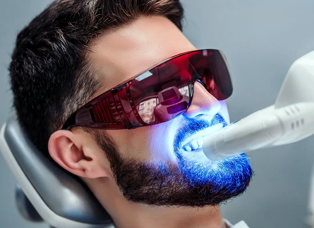 Signs you may need Teeth Whitening — Tammy N. Tran, D.D.S., Inc.
